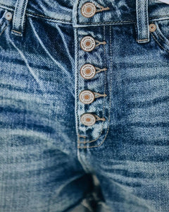 ✨ Women’s High-Waisted Denim Shorts – Button Detail, Casual Fit | Short en jean taille haute pour femme – Détails à boutons, coupe décontractée