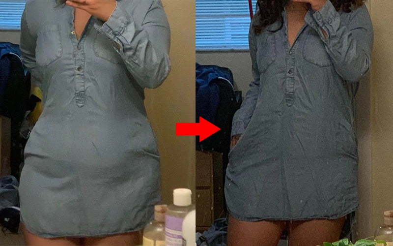 Postpartum Shapewear Shorts – High-Waist Support (S to M) | OWNLUXE